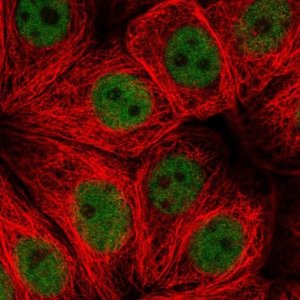 Anti-ZNF821 antibody produced in rabbit 