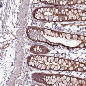 Anti-ZNF827 antibody produced in rabbit 