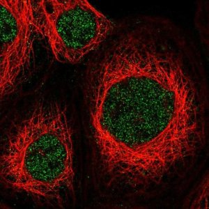 Anti-ZNF83 antibody produced in rabbit 