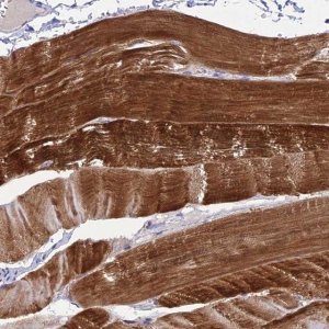 Anti-ZNF837 antibody produced in rabbit 