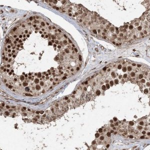 Anti-ZNF839 antibody produced in rabbit 