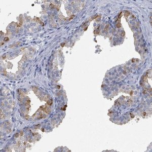 Anti-ZNF852 antibody produced in rabbit 