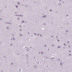 Anti-ZNF853 antibody produced in rabbit 