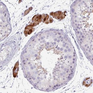 Anti-ZNF878 antibody produced in rabbit 