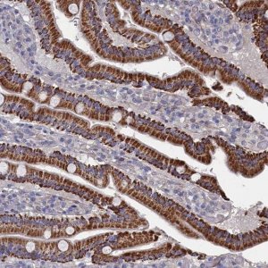 Anti-ZNF891 antibody produced in rabbit 