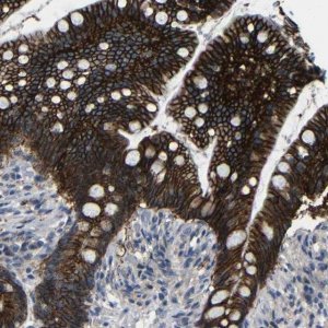 Anti-ZNF90 antibody produced in rabbit HPA003227-100UL