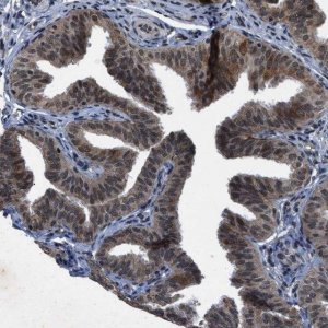 Anti-ZNHIT1 antibody produced in rabbit 
