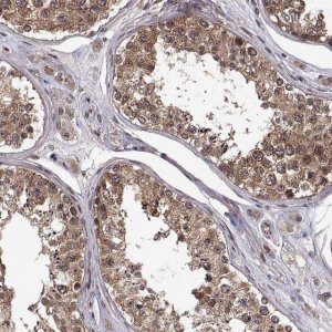 Anti-ZNRF2 antibody produced in rabbit 