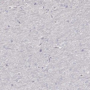 Anti-ZP3 antibody produced in rabbit 