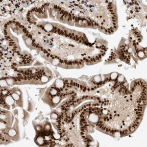 Anti-ZSCAN2 antibody produced in rabbit 