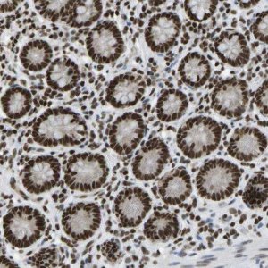 Anti-ZSCAN20 antibody produced in rabbit 