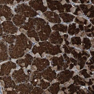 Anti-ZSCAN22 antibody produced in rabbit 