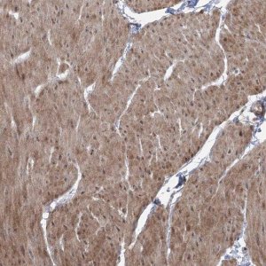 Anti-ZSCAN23 antibody produced in rabbit 