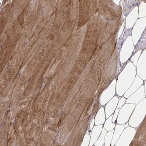 Anti-ZSCAN25 antibody produced in rabbit 
