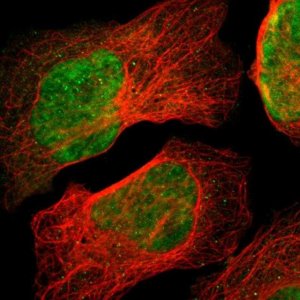 Anti-ZSCAN30 antibody produced in rabbit 