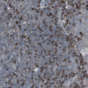 Anti-ZSCAN32 antibody produced in rabbit 