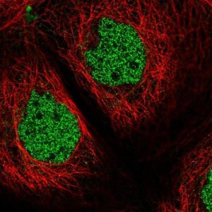Anti-ZSCAN32 antibody produced in rabbit 
