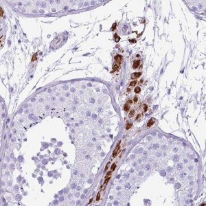 Anti-ZSCAN5A antibody produced in rabbit 