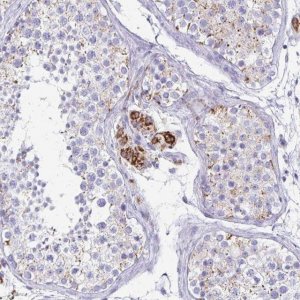 Anti-ZSCAN5B antibody produced in rabbit 