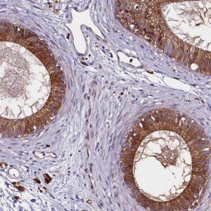 Anti-ZSWIM1 antibody produced in rabbit 
