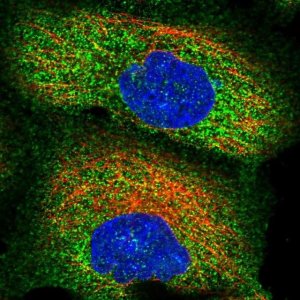 Anti-ZSWIM1 antibody produced in rabbit 
