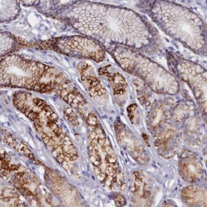 Anti-ZSWIM4 antibody produced in rabbit 