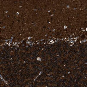 Anti-ZSWIM5 antibody produced in rabbit 