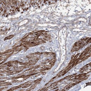 Anti-ZSWIM6 antibody produced in rabbit 