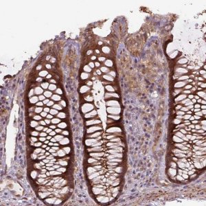 Anti-ZSWIM7 antibody produced in rabbit 