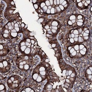 Anti-ZSWIM8 antibody produced in rabbit 