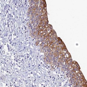 Anti-ZXDB antibody produced in rabbit 