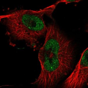 Anti-ZXDB antibody produced in rabbit 
