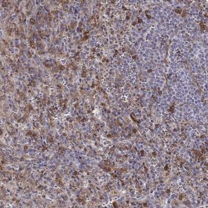 Anti-ZYX antibody produced in rabbit 