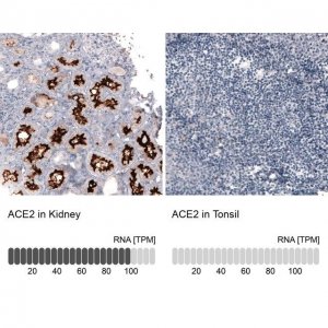 Monoclonal Anti-ACE2 antibody produced in mouse 