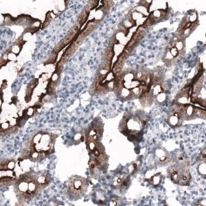 Monoclonal Anti-ACE2 antibody produced in mouse 