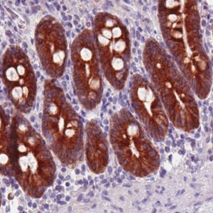 Monoclonal Anti-ACSL5 antibody produced in mouse 