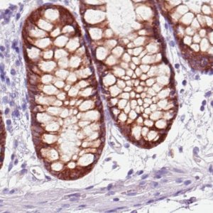 Monoclonal Anti-ACSL5 antibody produced in mouse 