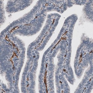 Monoclonal Anti-ADGRL4 antibody produced in mouse 
