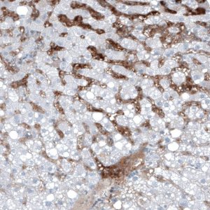 Monoclonal Anti-AFP antibody produced in mouse AMAB91610-100UL