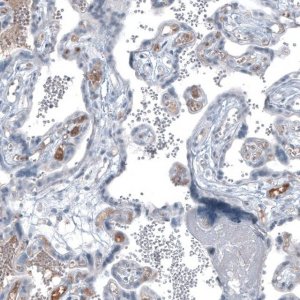 Monoclonal Anti-AFP antibody produced in mouse AMAB91610-100UL