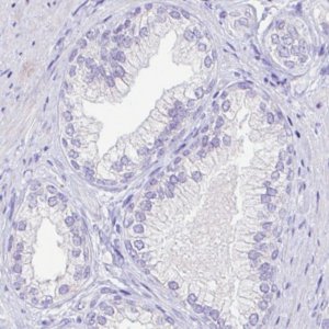 Monoclonal Anti-ARG1 antibody produced in mouse 
