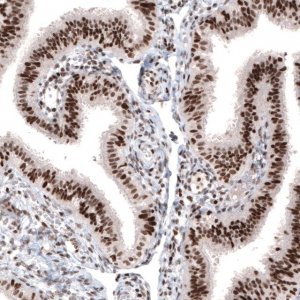Monoclonal Anti-ARID1A antibody produced in mouse 
