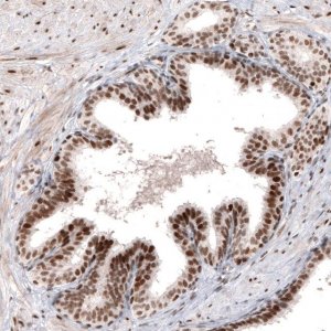 Monoclonal Anti-ARID1A antibody produced in mouse 