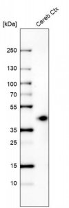 Monoclonal Anti-B3GAT1 antibody produced in mouse AMAB91575-100UL