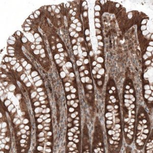 Monoclonal Anti-BAX antibody produced in mouse AMAB91490-100UL