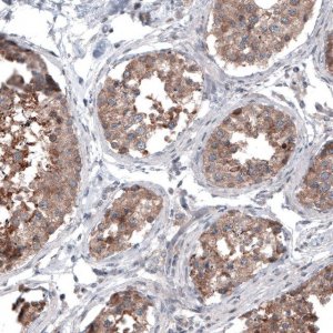 Monoclonal Anti-BRAF antibody produced in mouse 