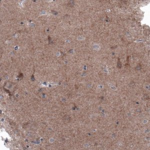 Monoclonal Anti-BRAF antibody produced in mouse 