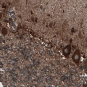 Monoclonal Anti-CARS antibody produced in mouse 