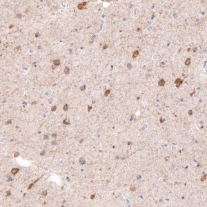 Monoclonal Anti-CDKL5 antibody produced in mouse 