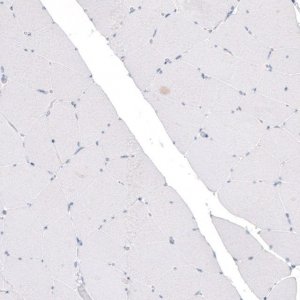 Monoclonal Anti-CDKL5 antibody produced in mouse 